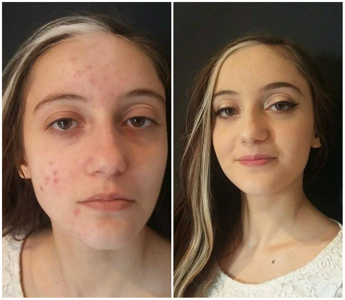 corso tecniche di camouflage modena make up artist trucco acne