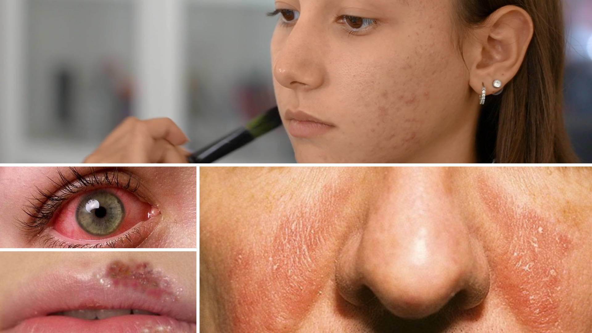 corso trucco make up preparazione pelle skincare acne vitiligine dermatite cosmetologia