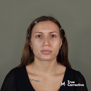 Case Study: Matilde TC16  • Corso Make Up Online